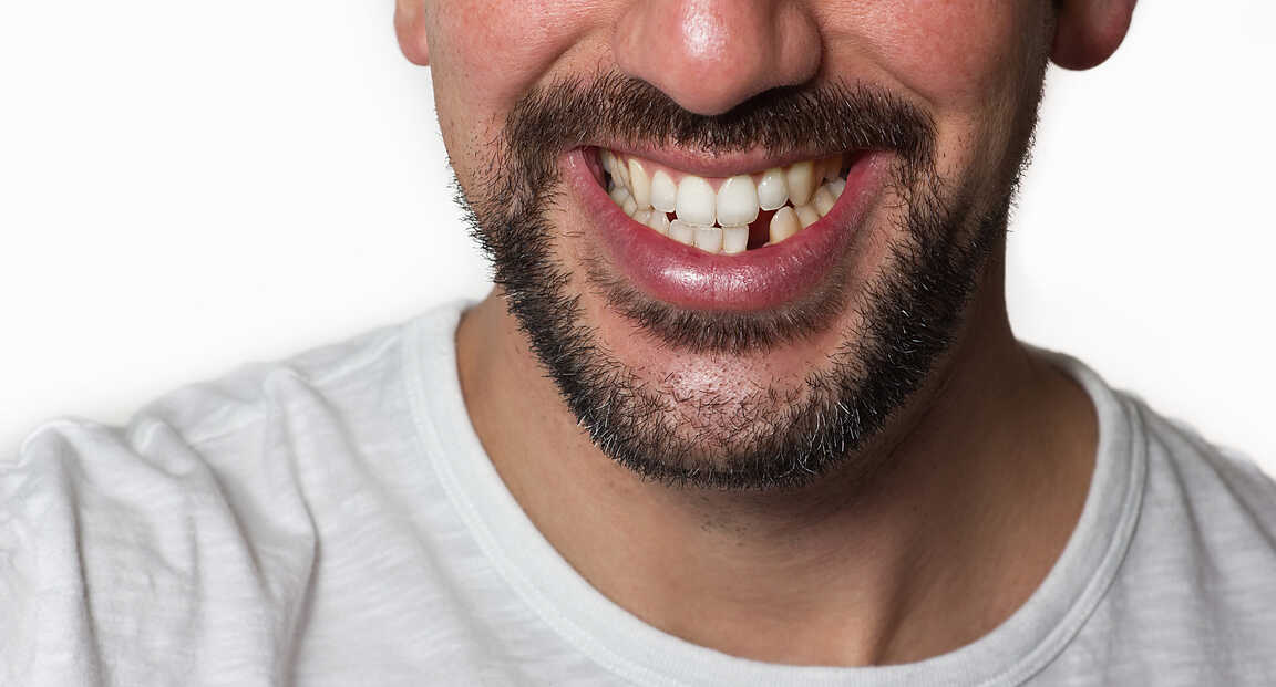 A foghiány nem csak esztétikai kérdés: hogyan írja át a mindennapi életet?